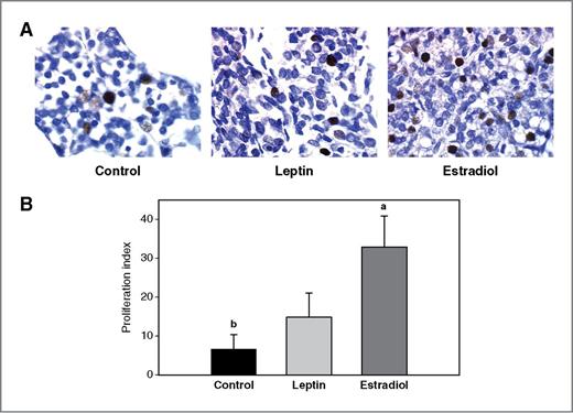 Figure 3. Effects of an exposure to leptin or estradiol during pregnancy on mammary gland cell proliferation, determined 17 weeks after pregnancy. A, PCNA staining (dark nuclei) in representative mammary gland sections (400× magnification), and B, proliferation index (percentage of PCNA positive cells/1,000 cells). All values are expressed as the mean ± SEM, n = 6 rats/group. Means with a different letter are significantly different from each other: P < 0.05.
