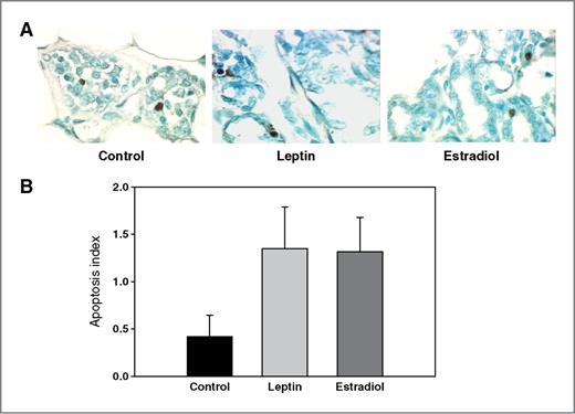 Figure 4. Effects of an exposure to leptin or estradiol during pregnancy on mammary gland apoptosis, determined 17 weeks after pregnancy. A, ISOL staining in representative mammary gland sections (400× magnification), and B, apoptosis index (percentage of ISOL positive cells/1,000 cells). All values are expressed as the mean ± SEM of 6 rats/group.