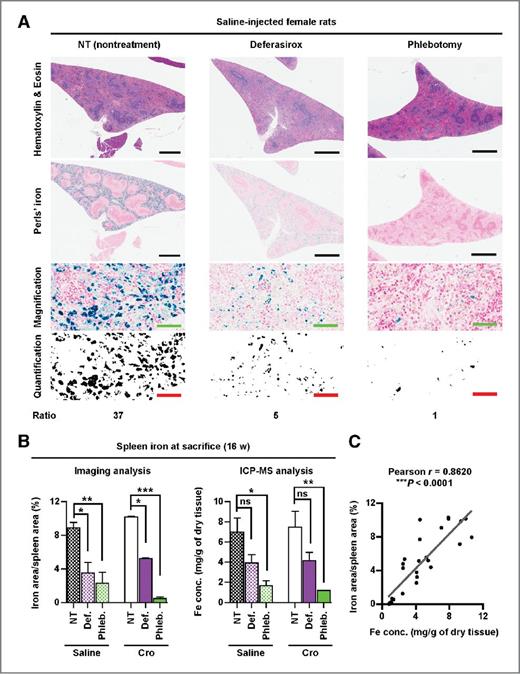 Figure 2. Iron reduction by deferasirox and phlebotomy in the 16-week experiment. A, histologic analysis of spleen. Perls' iron staining showed iron as blue green granules. Scale bars in top two panels, 1 mm; and bottom two panels, 50 μm. The ratio of iron deposition areas in each group is indicated (black) with image analysis at the bottom. B, amounts of iron in the spleen. Left, iron area was divided by the whole spleen area, to give index semiquantitatively reflecting the amount of splenic iron, as described in Materials and Methods. Right, splenic iron concentration measured with ICP-MS. P values (*, P < 0. 05, **, P < 0. 01, and ***, P < 0. 001) were determined by one-way ANOVA with a post hoc Tukey test. C, proportional association of splenic iron concentration with splenic image analysis described in (A) and (B).