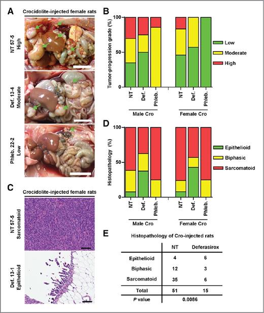 Figure 6. Deferasirox modulated the histopathology of mesotheliomas into less malignant type of mesotheliomas. A, macroscopic images of mesotheliomas at dissection. Nodular mesothelial tumors are indicated by green arrows. Scale bars, 2 cm. B, tumor-progression grade as the summation score of tumor size and dissemination (see Materials and Methods for details). C, histology of two types of mesotheliomas, epithelioid, and sarcomatoid subtypes. Scale bars, 100 μm. D, difference in the fraction of mesothelioma subtype. Biphasic tumors are defined as tumors in which each of epithelioid and sarcomatoid fraction occupies more than 10% of all the tumor cells in the histopathologic specimen. E, summary table of fraction of histologic subtypes of mesothelioma. Four rats in nontreatment group and one in deferasirox group were excluded, because pathologic diagnosis was not possible due to postmortem changes. Analysis by the χ2 test.