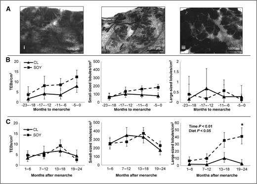 Figure 4. Quantification of TEBs and lobular structures in the breast of cynomolgus macaques fed a high-soy (SOY) or casein-lactalbumin (CL) diet across the pubertal transition. A, whole-mount images of the breast (toluidine blue staining) predominated by TEBs (i), small-sized lobule (ii), and large-sized lobule (iii). B, before menarche, the lobular number did not differ between diet groups. C, after menarche, the amount of large-sized lobules significantly increased and was higher in the SOY group. Values are LSM for n = 4–12 (CL) or 5–17 (SOY), error bars = SEM. The significant main effects are indicated in each panel. *, a difference between SOY and CL (P < 0.05) by LSM Tukey HSD test. Body weight and menstrual cycle stage (postmenarche) were included in the model as covariates.