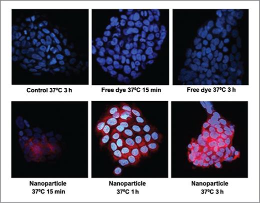 Figure 4. Cellular uptake of nanoparticles encapsulating both dye and luteolin in Tu212 cells. Tu212 cells were incubated with nanoparticles and free dye at 37°C for various time points. Confocal images show Tu212 cell uptake of nanoparticles 15 min, 1 hour, and 2 hours after incubation.