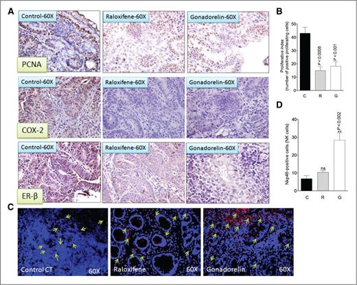 Figure 2. A, serial paraffin sections of intestinal tumors from ApcMin/+ mice were subjected to immunohistochemical analysis using an anti-PCNA, anti–COX-2, and anti–ER-β polyclonal antibody in treated and control tissues. Original magnifications, ×60. B, significant difference was observed in proliferative index between raloxifene- and gonadorelin-treated and control group polyps. C, immunohistofluorescence of intestinal tumors from ApcMin/+ mice for NK cells treated with raloxifene and gonadorelin. D, quantitative analysis of NK cells in intestinal tumors from ApcMin/+ mice treated with raloxifene and gonadorelin.