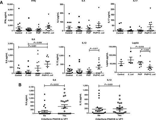 Figure 5. Serum cytokine analyses reveal increased systemic IL6 and IL12(p70) levels in PhIP + E. coli–treated animals and a positive correlation between systemic IL6 levels and the development of prostate cribriform PIN/CIS lesions. Serum levels of IFNγ, IL4, IL17, IL6, IL12(p70), and leptin as determined by Luminex assay (A). Significant differences are indicated, otherwise P > 0.05. Serum IL6 and IL12(p70) levels versus the presence or absence of cribriform PIN/CIS lesions in the ventral prostate (B). Only a subset of study animals were evaluated for leptin levels. Detectable levels of GM-CSF, IL1a, IL1b, IL10, and TNFα were not observed in more than one study animal in any of the treatment groups, therefore data are not shown.