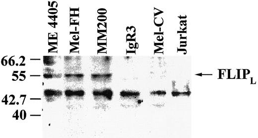 Fig. 5. Western blot showing detection of FLIP at Mr 55,000 by the polyclonal Ab AL129 in extracts of the melanoma lines Me4405, MM200, and Mel FH but not in IgR3, Mel CV, or Jurkat cell lines. Isotype control Ab was unreactive. The Mr 49,000 band is nonspecifically detected by the secondary Ab.