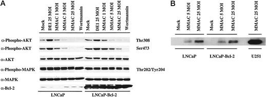 Fig. 1. Effect of MMAC/PTEN expression on signal transduction pathways. A, Western blot analysis of EGF-stimulated LNCaP and LNCaP-Bcl-2 cells infected with Ad-MMAC or control adenovirus (Ad-DE1). Forty-eight h after infection, cells were stimulated with EGF (50 ng/ml) for 10 min before harvest. Wortmannin treatment (1 μm) was for 30 min before stimulation. MMAC/PTEN expression inhibits phosphorylation of Akt at both activating residues (Thr-308 and Ser-473) without modifying levels of total Akt protein. MMAC expression did not affect phospho- or total MAPK, or Bcl-2, protein expression. Overexpression of Bcl-2 did not block the inhibition by MMAC/PTEN of Akt phosphorylation. B, Western blot analysis of MMAC/PTEN expression in LNCaP and LNCaP-Bcl-2 cells 48 h after infection with media alone (Mock) or increasing amounts (MOI) of Ad-MMAC. Far right lane, expression of MMAC/PTEN in U251 human glioblastoma cells harvested 48 h after infection with 25 MOI of Ad-MMAC. Gel was loaded with 50 μg of protein per lane. At 48 h, MMAC/PTEN is detectable in LNCaP cells infected with Ad-MMAC, but the amount of MMAC/PTEN protein is significantly less than that seen with identical infection of U251 glioma cells. Comparable levels of expression were seen at later time points. Equal loading was confirmed by immunoblotting with anti-actin antibody (not shown).