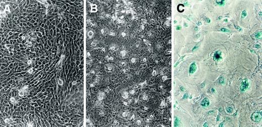 Fig. 1. Phase contrast microscopy and SA-β-galactosidase staining of proliferating and senescent normal human prostate epithelial cells in culture. A, early-passage HPECs demonstrate tightly juxtaposed cells that grow in large islands (phase microscopy, ×200). B, nonproliferating passage five HPECs demonstrate morphological changes consistent with senescence including flattened, enlarged cells, and multiple nuclei. C, SA-β-galactosidase staining (38) of nonproliferating prostate epithelial cells demonstrates blue nuclear/cytoplasmic staining indicating senescence (×400). Early-passage cultures (data not shown) were negative for SA-β-galactosidase staining.