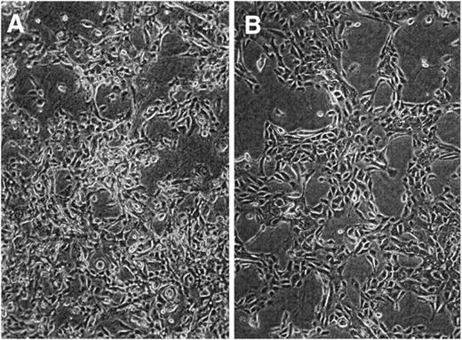 Fig. 3. Phase-contrast microscopy of HPV16 E6 and E7 HPEC lines. The morphology of HPV16 immortal cells was recorded at passage 20 in subconfluent dishes (×200 magnification). A, the morphology of E6 human prostate epithelial cell lines demonstrates irregular shaped, loosely packed cells with poor adherence. E6/E7 cell lines have a similar morphology (data not shown) to E6 lines. B, in contrast, E7 lines show flat, adherent cells with morphology similar to early-passage HPECs.
