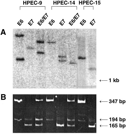 Fig. 4. Demonstration of HPV16 E6 and E7 DNA insertion and gene expression. A, Southern analysis for HPV16 insertions. DNA from the eight cell lines was harvested between passages 18 and 25, digested with HindIII, and probed with a radiolabeled 0.8-kb HPV16 fragment. Results show single bands in some lanes, demonstrating single sites for retroviral insertion and single clonal origin. Multiple bands seen in Lanes 1, 3, and 5 (from left to right) represent multiple viral insertion sites. B, RT-PCR for HPV16 E6 or E7 gene expression in human prostate epithelial cell lines. The HPEC cell lines immortalized with HPV16 E6, E7, or E6/E7 were assessed at passage 18–25 for expression of E6 and E7. Expression of the E6 (347 and 194 bp) and E7 gene products (165 bp) in immortalized HPEC cell sets (HPEC 9, 14, and 15) is shown. Each set is derived from separate single prostate epithelial tissue specimen.