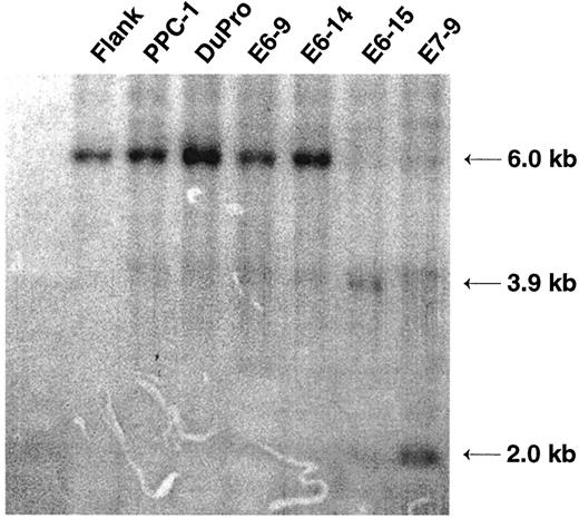 Fig. 6. Southern blot of p16/CDKN2 in HPV16-immortalized prostate epithelial cells and metastatic prostate cancer cell lines. The methylation-sensitive enzyme SmaI and flanking enzyme HindIII demonstrate hypermethylation (6.0 kb) in HPEC E6-9, HPEC E6-14, DuPro, and PPC-1 cell lines. Digestion fragments of 2.1 and 3.9 kb are shown in unmethylated cell lines HPEC E6-15 and E7-9. HPEC E6-15 contains a heterozygous deletion, as evidenced by the reproducible decrease in signal intensity. The other allele of HPEC E6-15 is unmethylated but mutated (see text).