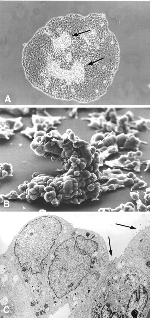 Fig. 4. Growth characteristics of OMIR cells after 5 days of culture in fibronectin-free CM199 (A) or fibronectin-rich SFM (B and C). Tridimensional processes arise from small cell monolayer (A and B, arrows). Microvilli are present in some of the OMIR cells lining these processes (C, arrows). A, ×150; B, ×580; C, ×5100.