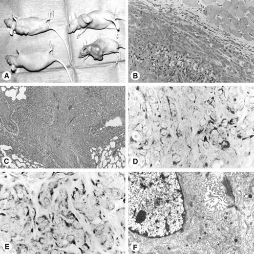 Fig. 7. Disfiguring tumors in BALB/c nude mice 3 weeks after injection with 5 × 106 OMIR cells (clones 2, 3, and 8). In contrast, the nude mouse in the left lower corner, free of tumor, had been given injections with OMCs (A). Histologically, the tumors were poorly differentiated, involving skeletal muscle (B). Clone 8-derived tumor metastasized to the lung (C). The tumor cells coexpressed cytokeratin (D) and vimentin (E), and revealed ultrastructural evidence of mesothelial differentiation (F).