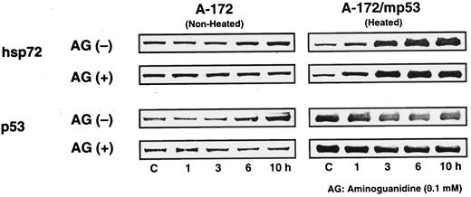 Fig. 3. Western blot analysis of hsp72 and p53 in A-172 cells cocultivated with heated A-172/mp53 cells. A-172/mp53 cells were heated at 44°C for 15 min. After transfer of A-172 cells on slide glasses to dishes of A-172/mp53 cells, cell cultures were incubated at 37°C for 1 to 10 h. AG, aminoguanidine.