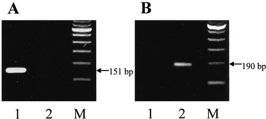 Fig. 1. Detection of fusion transcripts by seminested PCR using SSX1-specific (Lane 1) and SSX2-specific primers (Lane 2) in SS. A, SYT-SSX1 (case 24). B, SYT-SSX2 (case 9). M denotes a 100-bp ladder.