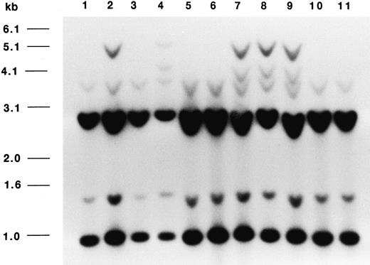 Fig. 3. Autoradiograph of a Southern blot of PstI-digested DNA from 11 male people hybridized with a probe corresponding to nt 18–309 of the GAGE-1 cDNA.