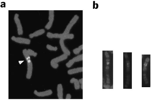 Fig. 6. a, partial metaphase spread showing hybridization of the GAGE-containing cosmid c7A to the proximal Xp11.2-p11.4 region (arrowhead). The X chromosome is labeled at the centromere with a X-specific α-satellite probe. b, additional chromosome X homologues showing signals in Xp11.2-p11.4.
