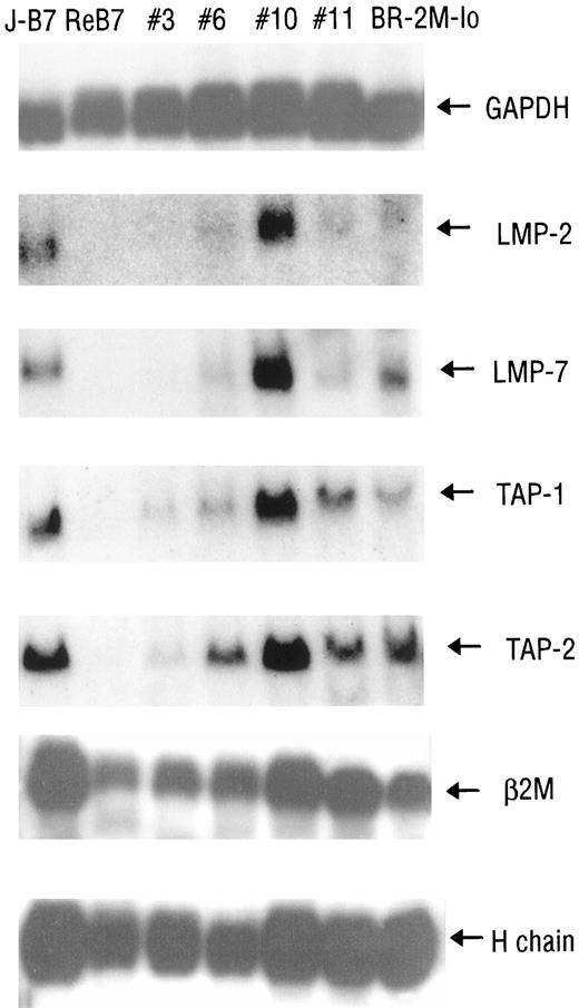 Fig. 7. Expression of multiple antigen presentation genes in the recurrent tumors as determined by Northern blot. Total RNA was isolated from J558-B7 and the recurrent tumor lines ReB7, Re#3, Re#6, Re#10, and Re#11 and the BR-2 MHClowB7+ subline. Equal aliquots of RNA were separated in an agarose gel and probed using GAPDH, TAP-1, TAP-2, LMP-2, LMP-7, H-2Db, and β-2 M 2probes.