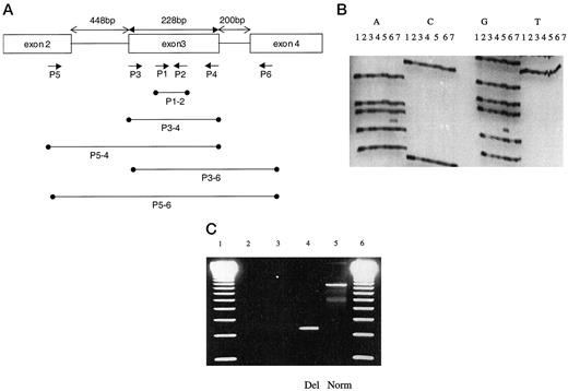 Fig. 1. Identification of CTNNB1 mutations. A, PCR strategy for CTNNB1 mutation detection. Primer pairs used to generate each of the five PCR products are as indicated. B, representative sequencing gel revealing point mutations in CTNNB1 exon 3. Colorectal carcinoma sample 54 (Lane 5) has an A to G substitution (S45P), and colorectal carcinoma sample 56 (Lane 6) has a G to A substitution (S45F). Sequencing reactions were run using the reverse primer P2. C, representative 2% agarose gel revealing intragenic deletion of CTNNB1 in PCR fragment P5-6. Carcinoma sample 128 (Lane 4, Del) has a 653-bp deletion. The deletion is not present in the adjacent adenoma sample (Lane 3). The full-length normal P5–6 PCR product is not successfully amplified from either of the paraffin DNA samples (Lanes 3 and 4). Lanes 1 and 6, 123-bp ladder; Lane 2, negative control; Lane 5 (Norm), full-length P5-6 PCR fragment from DNA extracted from peripheral blood lymphocytes.