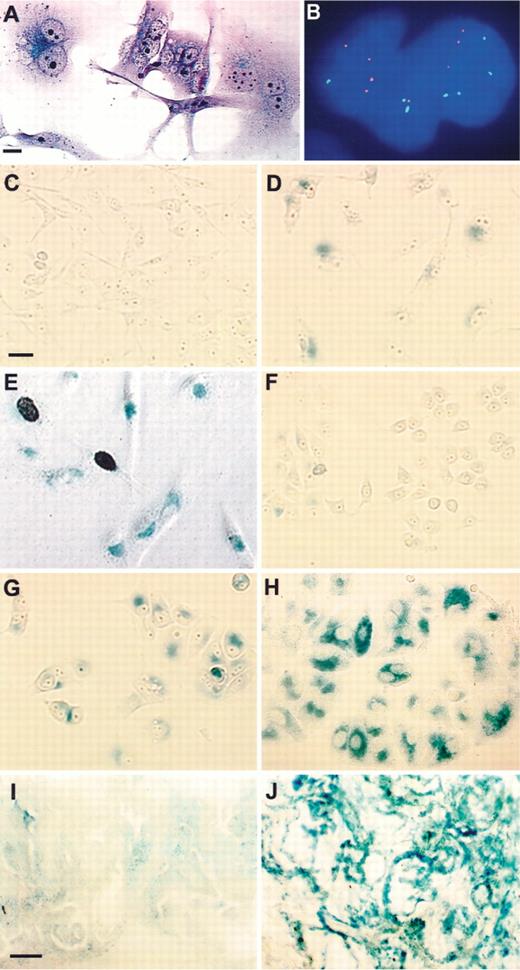 Fig. 2. Formation of micronuclei and SA-β-gal expression in drug-treated cells. Attached cells (A and C-H) or frozen sections (I and J) were fixed with 2% formaldehyde/0.2% glutaraldehyde and stained for SA-β-gal activity; cells were counterstained with H&E (A) and autoradiographed (E). The photographs were taken at 400-fold (A; 20-μm scale bar), 1000-fold (B), 200-fold (C-H; 50-μm scale bar in C), or 400-fold (I and J; 30-μm scale bar in I) magnification. A, multiple micronuclei in HT1080 (3′SS6) cells treated with 30 nm doxorubicin for 3 days. B, FISH analysis of chromosome distribution among the micronuclei in a partially fragmented nucleus of HT1080 cells treated with 20 nm doxorubicin for 3 days. Cells were hybridized with a mixture of fluorescent probes specific for chromosomes 18 (green) and 21 (red); nuclei were stained with DAPI (blue). C, untreated HT1080 cells. D, HT1080 3′SS6 cells exposed to 30 nm doxorubicin for 4 days. E, HT1080 3′SS6 cells treated with 20 nm doxorubicin for 3 days and grown without drug for 4 days, with [3H]thymidine added for the last 2 days. F, untreated MCF-7 cells. G, MCF-7 cells exposed to 50 nm doxorubicin for 2 days. H, MCF-7 cells exposed to 100 nm tRA for 8 days. I, xenograft tumor formed by MCF10AneoT cells in nude mice, untreated. J, MCF10AneoT xenograft treated in vivo with 4-HPR.