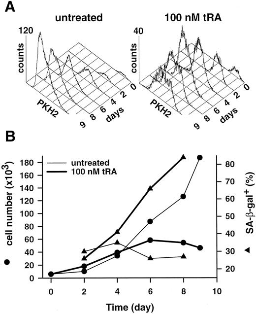 Fig. 4. Effects of tRA on MCF-7 cells A, PKH2 profiles of untreated MCF-7 cells and cells treated with 100 nm tRA for the indicated number of days. Each profile corresponds to the same number of initially plated cells. B, time course of changes in cell number (•) and percentages of SA-β-gal+ cells (▴) for MCF-7 cells, untreated or treated with 100 nm tRA.