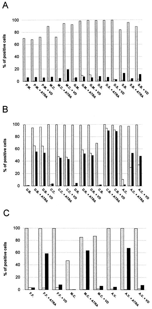 Fig. 1. Expression of CD45, CD14, and CD11b in M0/M1, M2, and M3-AML cell populations. The histograms show the levels of expression, as evaluated by flow cytometric analysis, of CD45 (hatched bars), CD14 (□), and CD11b (▪) surface markers in AML M0/M1 (five blast cell populations; A), AML M2 (five blast cell populations; B), and AML M3 (three blast cell populations; C) cells treated with ATRA or VD for 5 days or left untreated. The values are expressed in percentages. The reported results are the average of three different sets of experiments. Variability in each experiment was less than 10%.