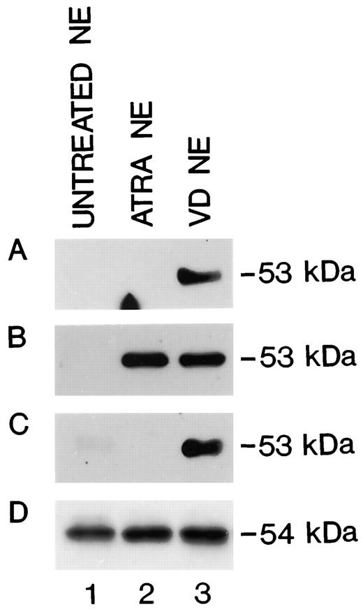 Fig. 3. Western blot analysis of VDR expression in AML-M0/M1, M2, and M3 blast cell populations. The presence of VDR protein was assayed in NEs obtained from AML- M0/M1 (A), M2 (B), and M3 (C) blast cell populations treated for 12 h with ATRA or VD or left untreated. Lane 1, NEs of untreated cells; Lane 2, NEs of ATRA-treated cells; Lane 3, NEs of VD-treated cells. D, RARα expression in NEs obtained from AML-M2 blast cell populations treated for 12 h with ATRA or VD or left untreated. The estimated molecular mass of VDR and RARα is indicated on the right side of each panel.
