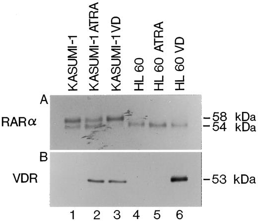 Fig. 5. Western blot analysis of RARα and VDR in Kasumi-1 and HL-60 cells. A, RARα protein expression in NEs from Kasumi-1 and HL-60 cells. B, VDR protein expression in NEs from Kasumi-1 and HL-60 cells. Lane 1, proliferating Kasumi-1 cells; Lane 2, Kasumi-1 cells treated for 12 h with ATRA; Lane 3, Kasumi-1 cells treated for 12 h with VD; Lane 4, proliferating HL-60 cells; Lane 5, HL-60 cells treated for 12 h with ATRA; Lane 6, HL-60 cells treated for 12 h with VD. Estimated molecular masses of RARα and VDR are indicated on the right side of each panel.