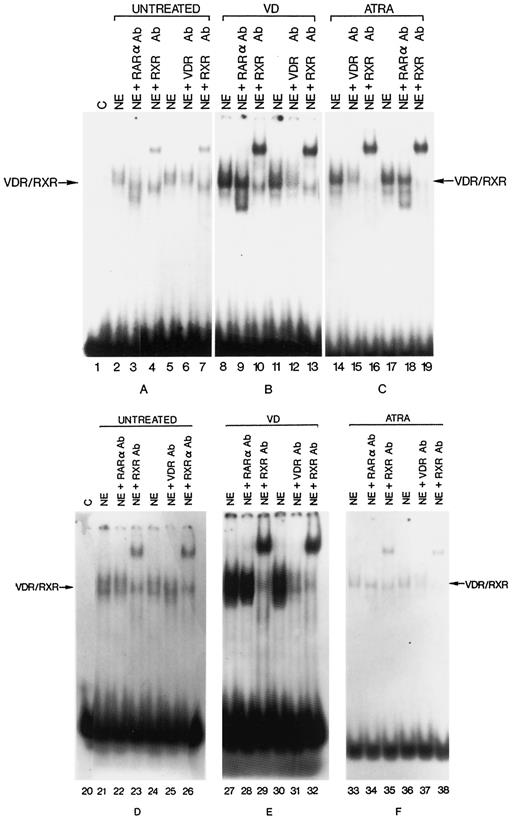 Fig. 6. EMSA of VDR after binding to a DR3-type DNA element in NEs of Kasumi-1 and HL-60 cells. NEs from untreated, VD-treated (12 h), or ATRA-treated (12 h) Kasumi-1 cells (A, B, and C, respectively) and from untreated, VD-treated, and ATRA-treated HL-60 cells (D, E, and F, respectively) were assayed for specific binding to a 32P-labeled DR3-type DNA element. To assess the identity of nuclear receptors participating in the shifted complexes, antibodies to RARα, RXR, and VDR were used. The arrow indicates the position of shifted complexes containing VDR and RXR.