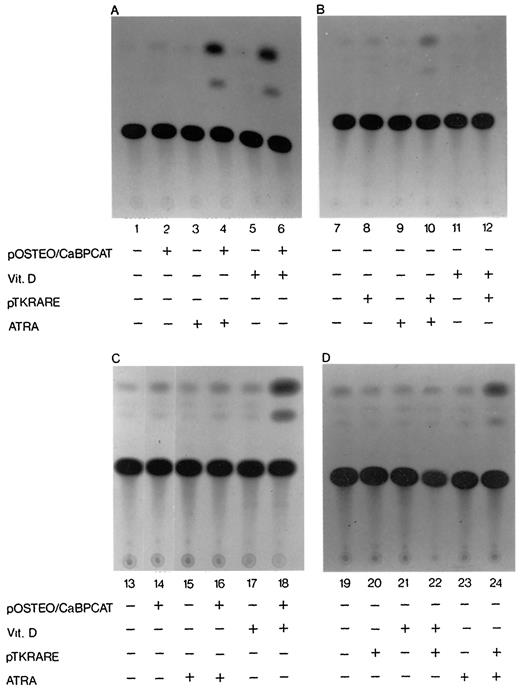 Fig. 7. CAT assays of transfected Kasumi-1 and HL-60 cells. pOSTEO/CaBPCAT (A and C) or pTK/RAREβ2-CAT (B and D) was transfected in Kasumi-1 (A and B) and HL-60 (C and D) cells. Where indicated, cells were treated with ATRA or VD for 48 h. Amounts of cell extracts used were normalized to the same value of the β-galactosidase activity.