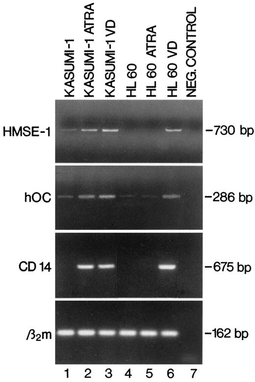 Fig. 8. Detection by RT-PCR of HMSE-1, hOC, and CD14 mRNAs in Kasumi-1 and HL-60 cells treated with ATRA or VD or left untreated. Lane 1, proliferating Kasumi-1 cells; Lane 2, Kasumi-1 cells treated for 12 h with ATRA; Lane 3, Kasumi-1 cells treated for 12 h with VD; Lane 4, proliferating HL-60 cells; Lane 5, HL-60 cells treated for 12 h with ATRA; Lane 6, HL-60 cells treated for 12 h with VD; Lane 7, negative control performed without the cDNA template. RT-PCR products of β2m mRNA are shown in the bottom panel.