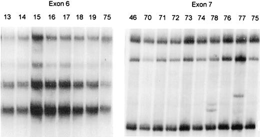 Fig. 1. SSCP analysis of exons 6 and 7 of AFB1-induced whole lung tumor DNA. Sample 15 has an altered banding pattern for exon 6 compared to nontumor sample 75 (normal), whereas samples 77 and 78 have altered banding patterns for exon 7 compared to sample 75.