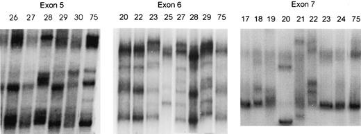 Fig. 2. SSCP analysis of exons 5, 6, and 7 of AFB1-induced microdissected lung tumor DNA. Samples 28 and 29 have altered banding patterns for exon 5 compared to nontumor sample 75 (normal); samples 23, 25, 27, 28, and 29 have altered banding patterns for exon 6 compared to sample 75; and samples 18–22 have altered banding patterns for exon 7 compared to sample 75.