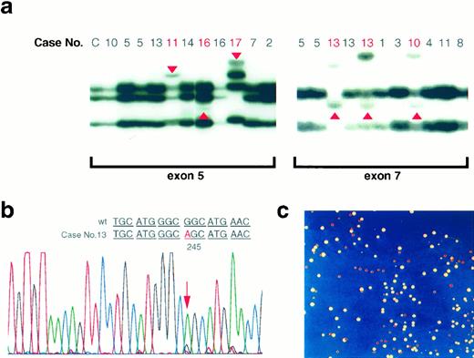 Fig. 1. Results of mutational analyses of the p53 gene for lesions in patients living in radiocontaminated areas of Ukraine. a, PCR-SSCP analysis of p53 gene exons 5 (left panel) and 7 (right panel) using DNAs prepared from altered urothelium. Case numbers with mutations are shown in red. Case C is human genomic DNA (Promega) used as a control. b, sequence analysis of case 13 revealed a GGC (Gly) to AGC (Ser) transition mutation at codon 245. c, yeast functional assay of case 17 gave 29% red colonies.