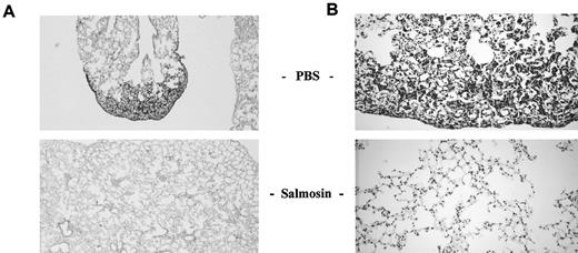 Fig. 6. Histochemical analysis of pulmonary metastatic Lewis lung carcinoma. Lung tissues isolated from the PBS- or salmosin-treated mice were fixed for 4 h in Bouin’s solution before being embedded in paraffin. Sections were stained with H&E. A, ×40; B, ×200.