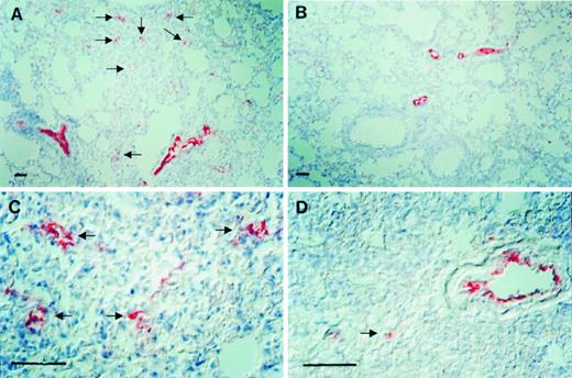 Fig. 7. Inhibition of tumor-induced angiogenesis in pulmonary Lewis lung carcinoma tissue by salmosin. Immunohistochemical analysis was performed as described under “Materials and Methods.” Lung tumor tissues were cut and stained with polyclonal antibody against factor VIII. Positive color detection was carried out by substrate reaction with 3-amino-9-ethylcarbazole (AEC). A and C, PBS-treated control tumor sections; B and D, salmosin-treated tumor sections. Scale bar, 30 μm.