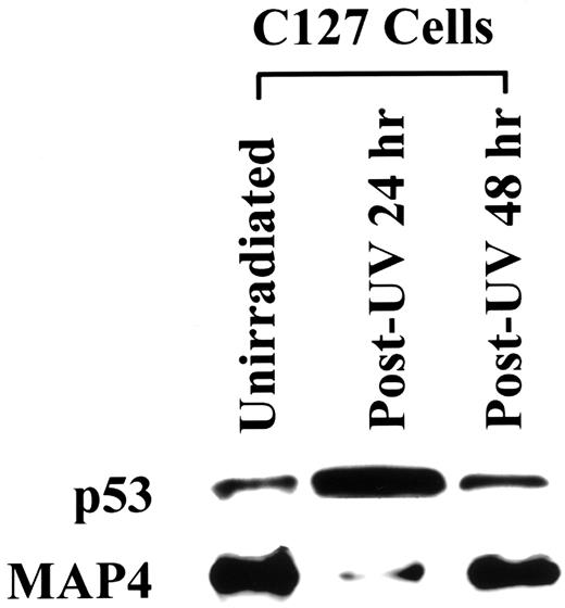 Fig. 1. Effect of UV irradiation on induction of wild-type p53 and MAP4 protein expression. Exponentially growing C127 cells were treated with 10 J/m2 of UV irradiation. Total protein was collected and analyzed 24 and 48 h following irradiation. Loading was normalized to protein concentration, and equal transfer was measured by Coomassie Blue staining of the transferred gels. p53 and MAP4 expression was assayed by Western analysis as described in “Materials and Methods” using monoclonal antibodies Pab240 and IF5 MAP4, respectively. The Western blot shown is a representative of three separate experiments.