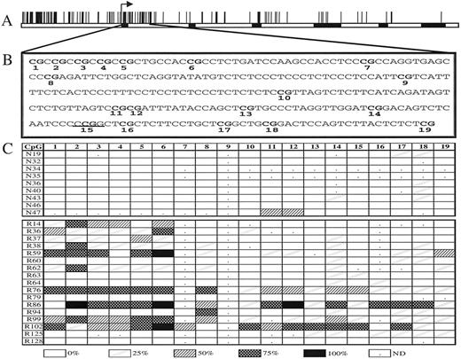 Fig. 1. Methylation map of the calcitonin gene. A, CpG plot across the calcitonin gene. The black boxes show coding regions within the gene. The arrow shows the start of transcription. B, DNA sequence analyzed by bisulfite genomic sequencing from bases 1891–2168 (accession number X15943). CpG dinucleotides are in bold and numbered below each site. The HpaII site is underlined. C, methylation maps derived from direct PCR sequence analysis for normal and leukemic samples. The sample number is in the left column, and the CpG sites are numbered across the top row., up to 25% methylation; ▨, 26–50% methylation; , 51–75% methylation; ▪, 76–100% methylation; □, no methylation;, the methylation at that site was not determined due to enzyme stoppage in the sequence.