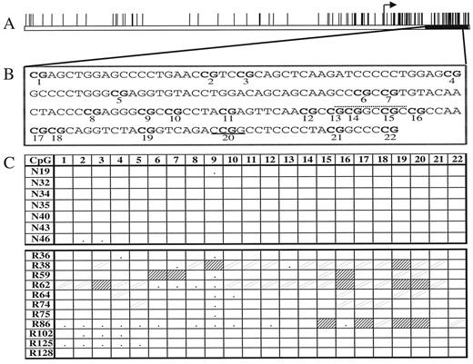 Fig. 2. Methylation map of the ER gene. A, CpG plot of the 5′ flanking region. The black box shows the start of the coding region, and the arrow shows the start of transcription. B, sequence of the CpG island that was analyzed from bases 3066–3250 (accession number X62462). CpG dinucleotides are in bold and numbered below each site. The HpaII site is underlined in bold, and the NotI site is shown by a dotted line above the sequence. C, methylation maps derived from direct PCR sequencing analysis for normal and leukemic samples. Symbols are the same as Fig. 1<$REFLINK>.
