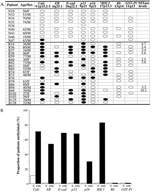 Fig. 7. Summary of hypermethylation results in AML. A, individual genes were scored as hypermethylated if they were methylated by genomic sequencing if levels in the sample were >25% at any one CpG site or in 25% or more of the determinable CpG sites. Black ovals, methylated; white ovals, unmethylated; no oval, not determined. Methylation status for p15 in patients R103 and R86 and for ER in patient R103 was determined by Southern analysis only. Footnote a, chromosome loci of the genes are given below the gene name. Footnote b, hypermethylation of HIC1 intron 2. Footnote c, MTase levels represent the fold increase of DNA MTase to the mean of the normal controls DNA MTase level (6). B: ▪, proportion of AML samples methylated for each target gene; □, proportion of normal samples (N) methylated for each target gene.