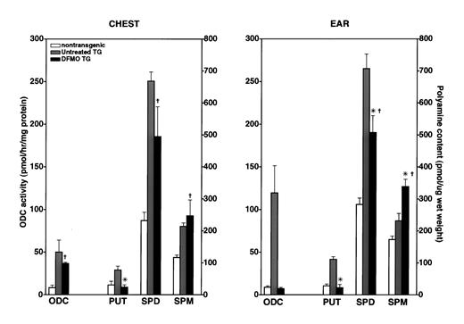 Fig. 7. Skin ODC activity and polyamine content after DFMO chemoprevention from 4 to 32 weeks of age. DFMO treatment decreases ODC activity, tissue putrescine, and spermidine contents during epidermal neoplastic progression. In contrast, spermine content increases in response to DFMO chemoprevention, suggesting that distal polyamine metabolic pathways may compensate for ODC inhibition by DFMO. *, P < 0.05, Mann-Whitney U test, DFMO versus untreated (control) transgenic mice; , DFMO-treated transgenic compared with nontransgenic mice. Bars, SD.