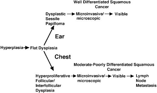Fig. 8. Divergent pathways of epidermal carcinogenesis in K14-HPV16 transgenic mice. Both chest and ear skin sites display similar early stages of hyperplasia and “flat” dysplasia (see legend to Fig. 1<$REFLINK>) but develop distinctive precursor lesions at 16 weeks of age. Microscopic cancers of different grades of differentiation and biological behavior develop from these precursor lesions by 32 weeks of age.