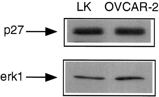 Fig. 3. Western blot analysis of p27 levels in OVCAR-2 ovarian cancer cell line and human ovarian surface epithelium (LK). Samples express comparable levels of p27 protein.