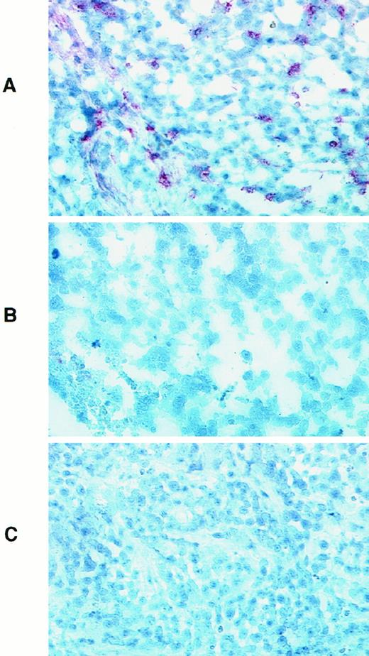 Fig. 6. Macrophage recruitment in biopsies derived from mock- or IL-17-transfected HeLa cells transplanted into nude mice. Cryostat section of biopsies derived from IL-17-transfected (A and B) or mock-transfected HeLa cervical carcinoma (C) transplanted into nude mice were fixed in acetone and incubated with biotinylated rat anti-Mac1 (A and C) or isotype-matched control biotinylated rat mAb. After washes in TBS, slides were incubated with alkaline phosphatase-conjugated streptavidin, and enzymatic activity was revealed with the Fast Red reagent. Sections were counterstained with Mayer’s Hematoxylin.