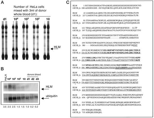Fig. 1. Identification of an OXYB homologue cDNA by DD. A, section of the DD gel demonstrating the differential expression of HLM cDNA in blood samples containing HeLa cells. B, Northern blot analysis confirming the differential expression of HLM in HeLa cells. The blot was stripped and reprobed with ubiquitin for normalization. Numbers below lanes, n-fold increase over normal blood. RNA was isolated after mixing 10–104 HeLa cells with 3 ml of d1 blood sample; Lanes d1-d3, independent tumor-free donor blood samples. C, alignment of HLM-deduced amino acid sequence with the human OXYB (OXYB h). Underlined, the oxysterol-binding domain; boldface, conserved amino acid sequences in the functional domain; double-underlined, the consensus motif of OXYB-family.