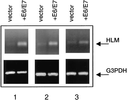 Fig. 2. Expression of the HPV oncoproteins E6 and E7 induces HLM mRNA expression. mRNA was isolated from pooled primary HFK infected with vector alone or with HPV16 E6 and E7 as indicated. RT-PCR was performed with primer sets to amplify HLM and G3PDH RNAs. 1, 2, 3, independent pools of infected HFKs.