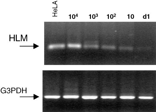 Fig. 6. Sensitivity of HLM in detecting HeLa cells in blood samples. Blood RNA samples containing a serial dilution of HeLa cells were evaluated for HLM expression. The samples were subjected to one round of 35 cycles of amplification by RT-PCR and analyzed in a 1.2% agarose gel after ethidium bromide-staining. HeLa, cervical cancer cells line; Lanes 10–104, number of HeLa cells mixed with 3 ml of blood before RNA extraction; Lane d1, donor blood sample. All of the samples were also amplified for G3PDH.
