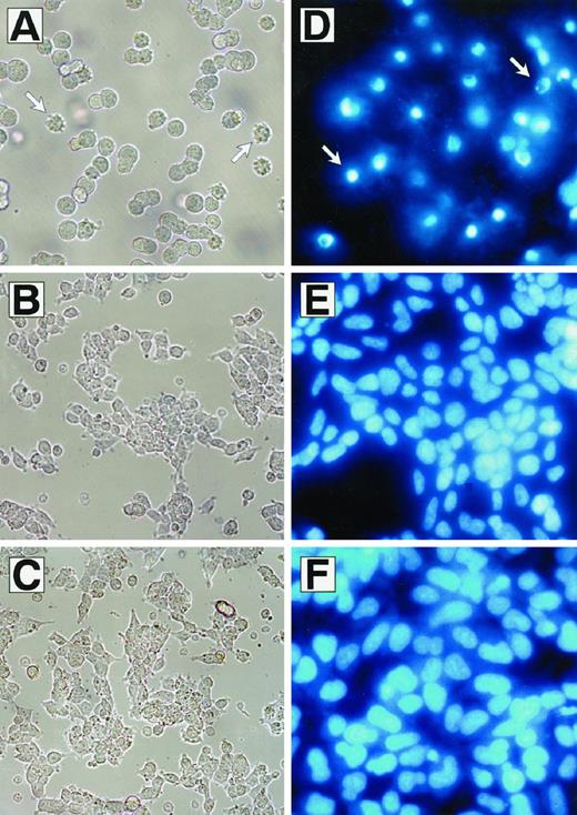 Fig. 1. Natural anti-NB IgM-induced apoptosis of human NB cells. The cells were analyzed by light microscopy (A–C) or fluorescence microscopy after staining with Hoechst 33258 (D–F). Shown is the morphology of LA-N-1 cells after incubation with the purified IgM fraction from an anti-NB IgM-positive (A and D) or negative donor (B and E). Untreated control cells are also shown (C and F). Arrows mark apoptotic cells with bleb formation (A) or condensed nuclei (B). A–F: ×400.