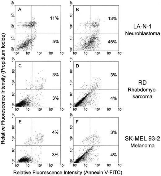 Fig. 2. Cytofluorometric analysis of anti-NB IgM-induced apoptosis. LA-N-1 neuroblastoma cells (A and B), RD rhabdomyosarcoma cells (C and D), and SK-MEL-93-2 melanoma cells (E and F) were incubated for 4 h with purified human IgM obtained from anti-NB IgM positive (B, D, and F) or negative (A, C, and E) donors, stained with propidium iodide and Annexin V-FITC, and analyzed by cytofluorometry.