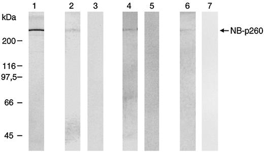 Fig. 5. Analysis of the purified NB-p260 protein, murine anti-NB-p260 IgG, and chicken anti-NB-p260 IgY by SDS-PAGE and immunoblot. Lane 1 shows purified NB-p260 after SDS-PAGE and silver staining. The NB-p260 antigen is recognized by human anti-NB IgM (Lane 2), murine anti-NB-p260 IgG (Lane 4), and chicken anti-NB-p260 IgY (Lane 6). No reactivity was seen with the human IgM fraction from a negative donor (Lane 3), murine preimmune IgG (Lane 5), and chicken preimmune IgY (Lane 7). kDa, Mr × 103.