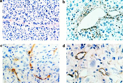 Fig. 3. a, antibody against CD31 was used to localize blood vessels in untreated MCa-IV. A collapsed vessel identified by CD31 staining extends for >200 μm through the tumor tissue (magnification, ×1210). b, staining of apoptotic cells by the TUNEL technique. At 24 h after paclitaxel, several apoptotic cells can be observed in the perivascular region (magnification, ×250). c and d, sections of HSTS-26T tumors stained with the antibody against CD31. c, in untreated HSTS-26T, several vessels have a collapsed lumen (magnification, ×250). d, at 120 h after the injection of docetaxel, several vessels with an open lumen are observed (magnification, ×375).